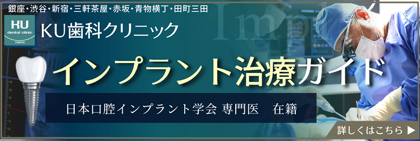 インプラント治療ガイド