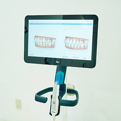 口腔内スキャナーでスピーディーに精密な印象採取